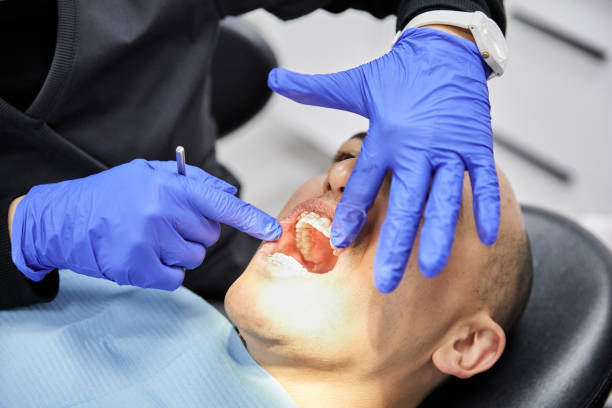 Best Emergency Dentist for Lost Fillings or Crowns in Glenshaw, PA